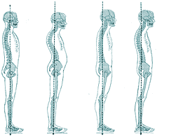 Diagram of four typical postural types
